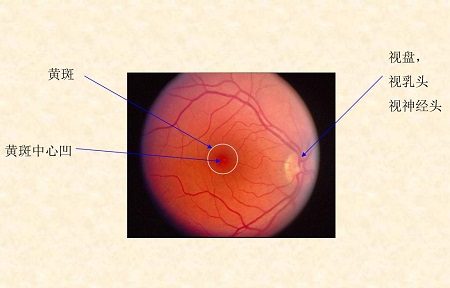黄斑是什么
