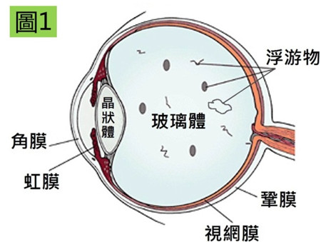 飞蚊到底是什么