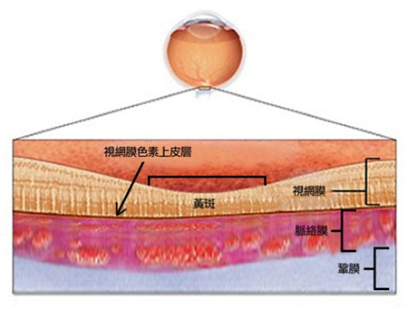 中浆危及视力