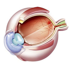 糖尿病与黄斑的关系