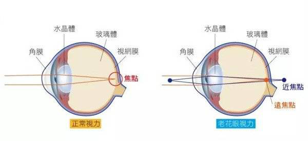 近视就不会患上老花眼?近视的你别等老花找上门才了解真相!