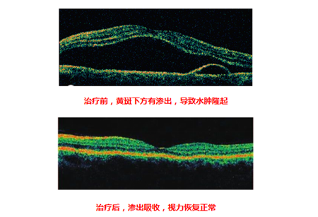 中浆治疗