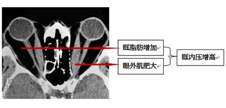 北京甲状腺治疗