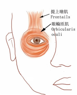 眼睑痉挛