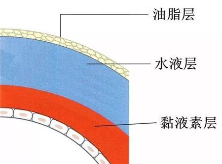 干眼症是什么原因引起的